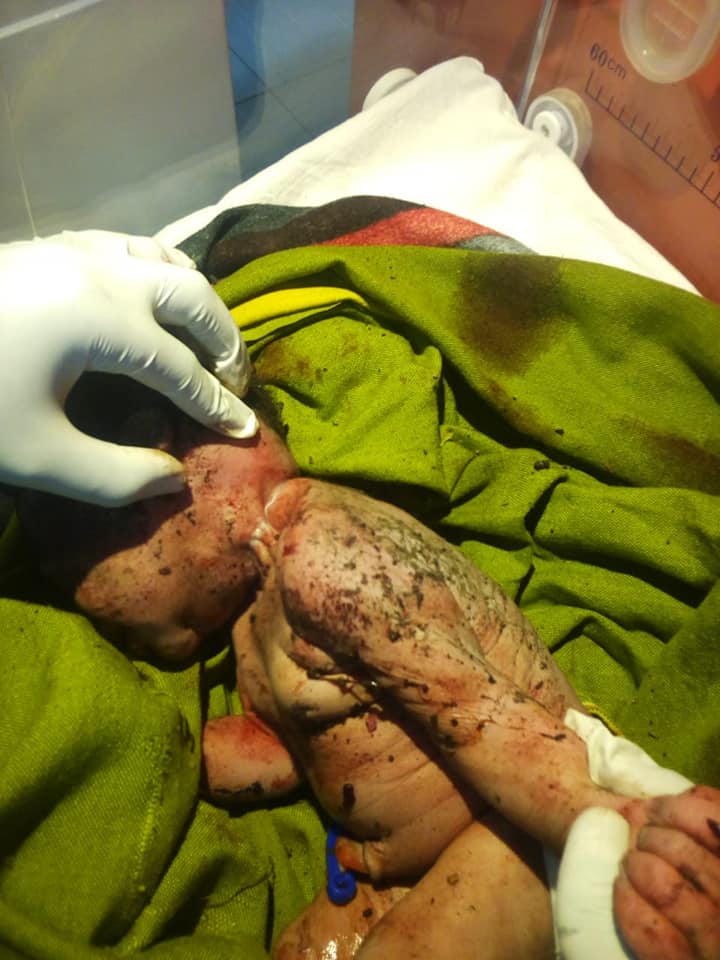 Attempted Murder: Nairobi woman dumps newborn after strangling it with rope  